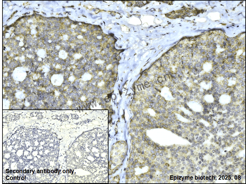 Anti-SPRY2 Rabbit mAb [13P83L78]