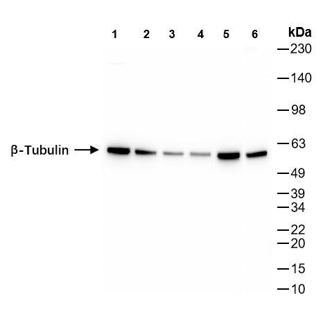 β-tubulin兔单克隆抗体