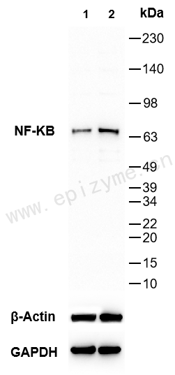 Anti-PIK3CA Mouse mAb [95R97F38]