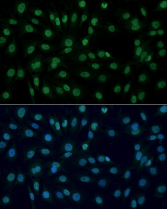 Anti-PARP1 Rabbit pAb