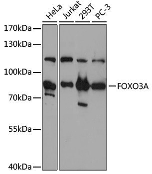 Anti-FOXO3A Rabbit pAb