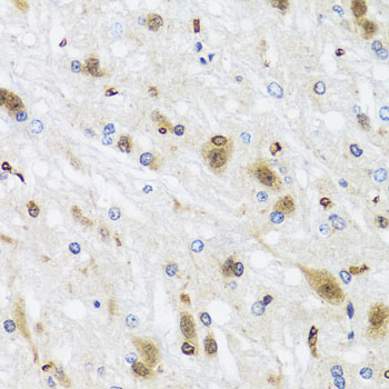 Anti-HDAC4 Rabbit pAb