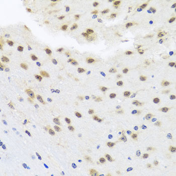 Anti-HDAC4 Rabbit pAb
