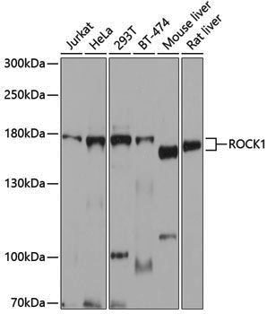 Anti-ROCK1 Rabbit pAb