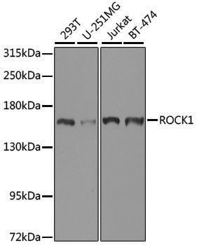 Anti-ROCK1 Rabbit pAb