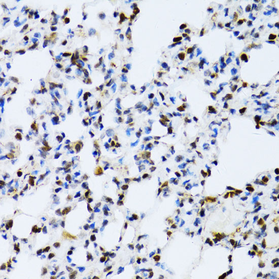 [KD Validated] Anti-ERK1 Rabbit pAb