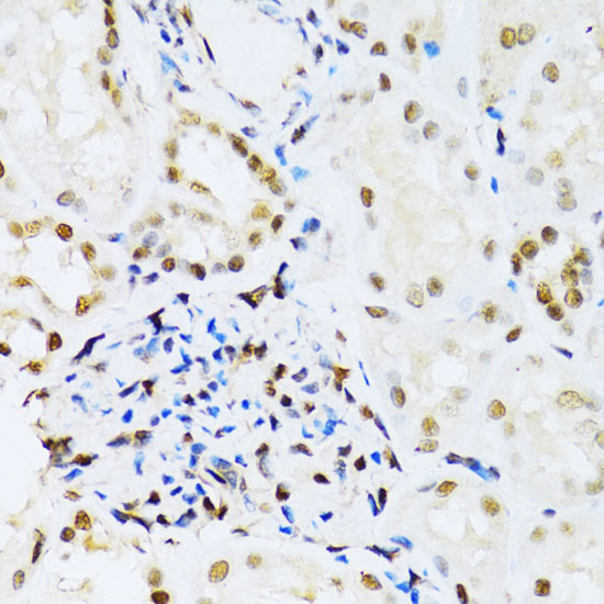 [KD Validated] Anti-ERK1 Rabbit pAb