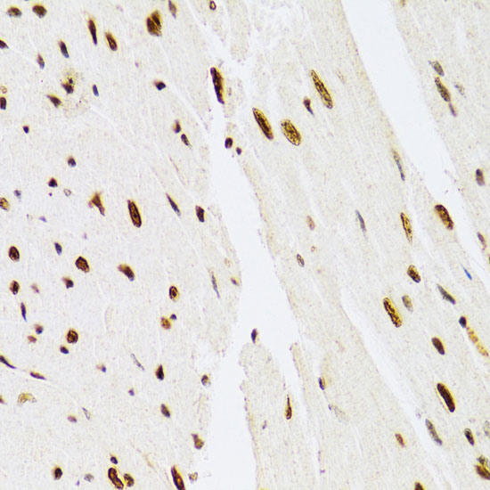 [KD Validated] Anti-ERK1 Rabbit pAb
