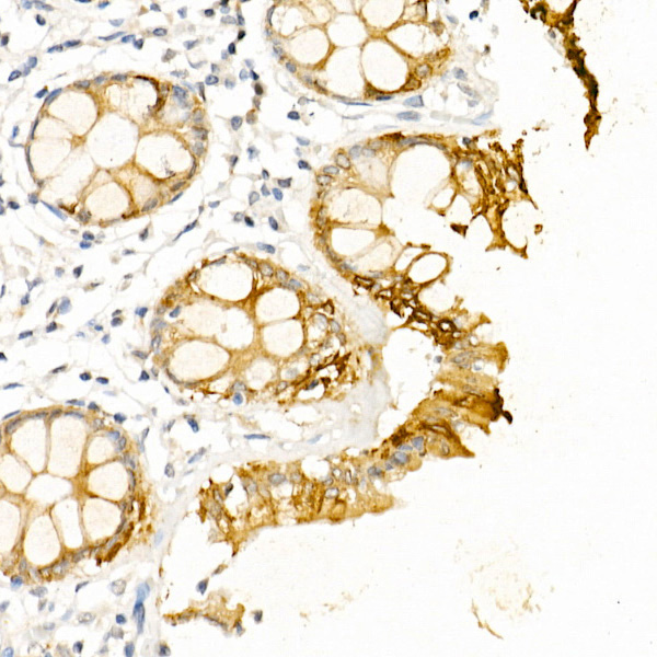 Anti-Cytokeratin 19 Rabbit pAb