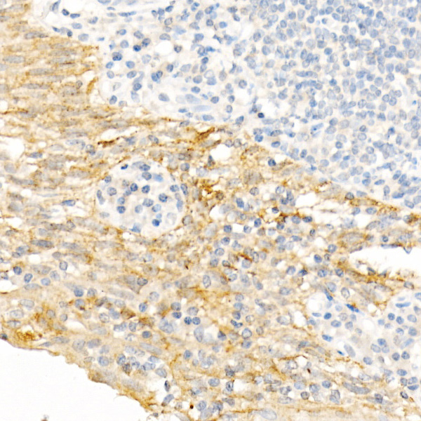 Anti-Cytokeratin 19 Rabbit pAb
