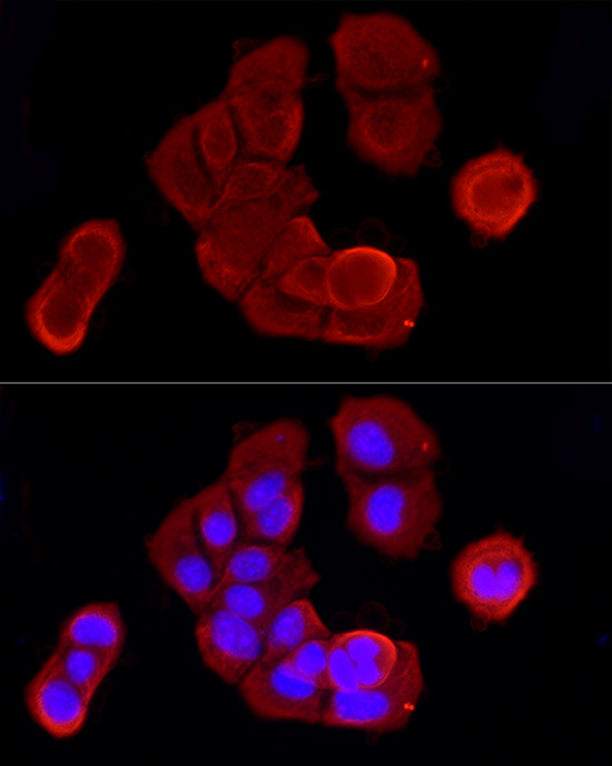 Anti-Cytokeratin 19 Rabbit pAb