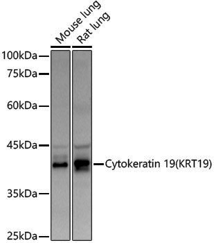 Anti-Cytokeratin 19 Rabbit pAb