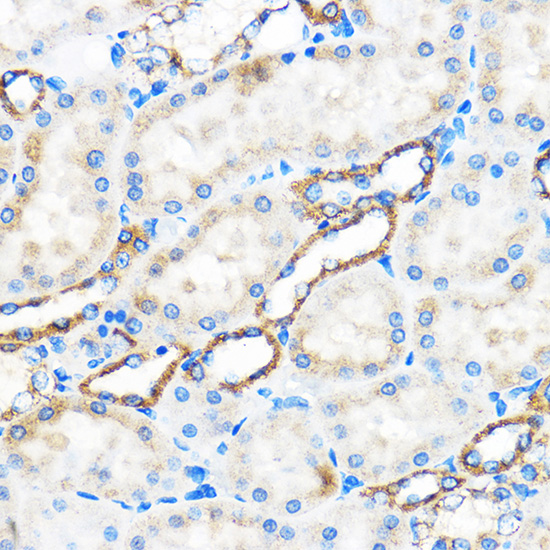 [KO Validated] Anti-ATG5 Rabbit pAb