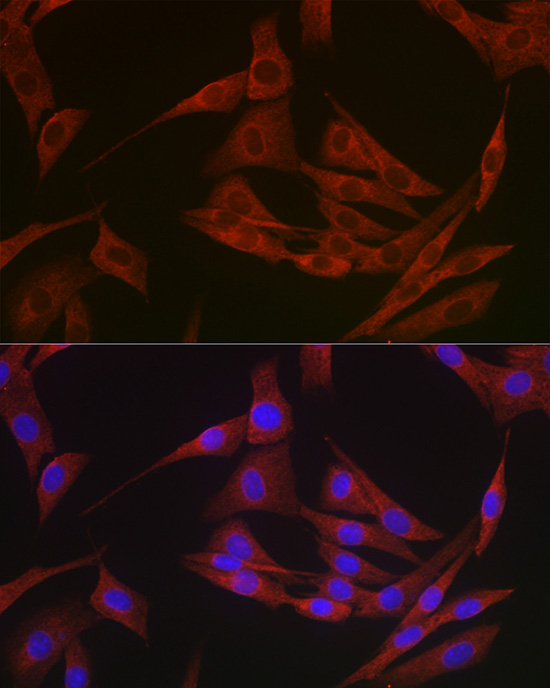 Anti-BCL2 Rabbit pAb