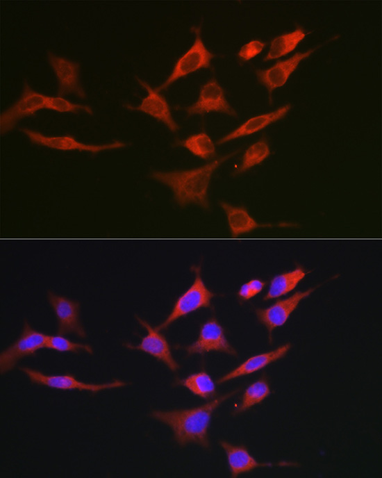 Anti-BCL2 Rabbit pAb