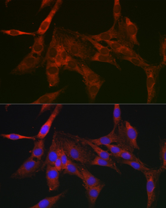 Anti-BCL2 Rabbit pAb