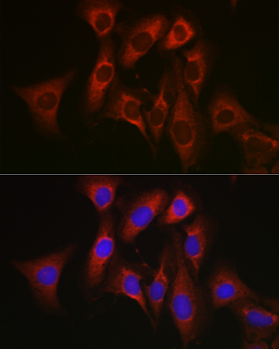 Anti-BCL2 Rabbit pAb