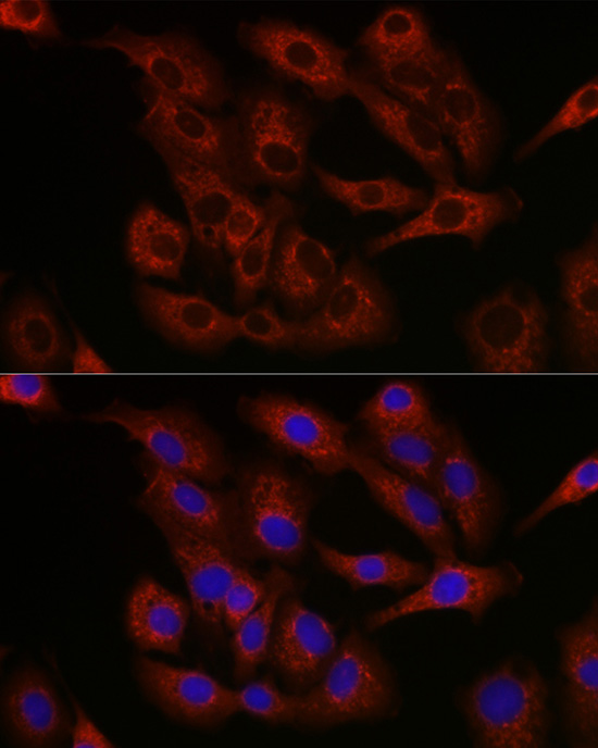 Anti-BCL2 Rabbit pAb