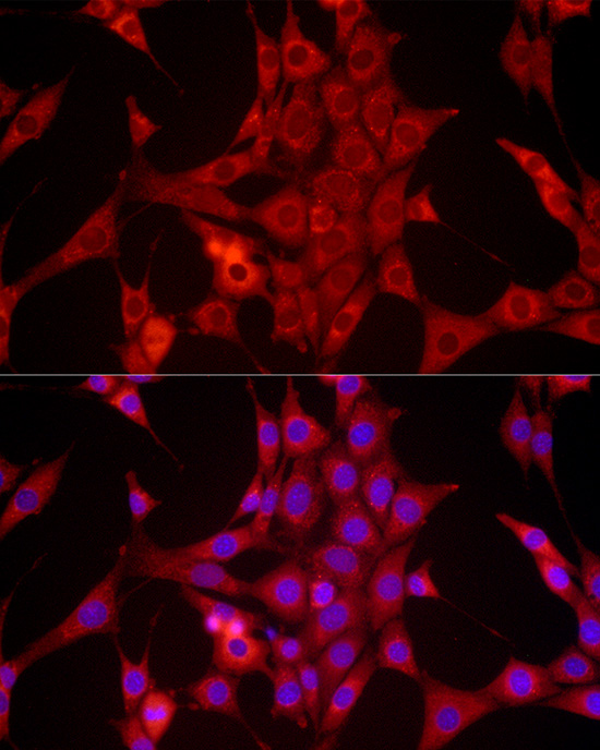 Anti-BCL2 Rabbit pAb