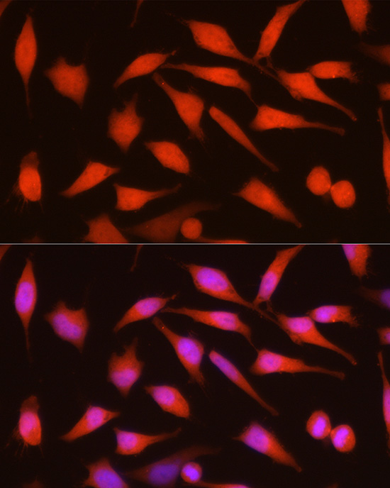 [KO Validated] Anti-CDKN2A/p16INK4a Rabbit pAb