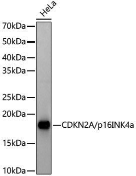[KO Validated] Anti-CDKN2A/p16INK4a Rabbit pAb