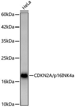 [KO Validated] Anti-CDKN2A/p16INK4a Rabbit pAb