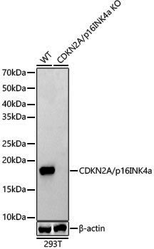 [KO Validated] Anti-CDKN2A/p16INK4a Rabbit pAb