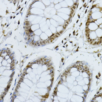 Anti-p27 Kip 1 Rabbit pAb