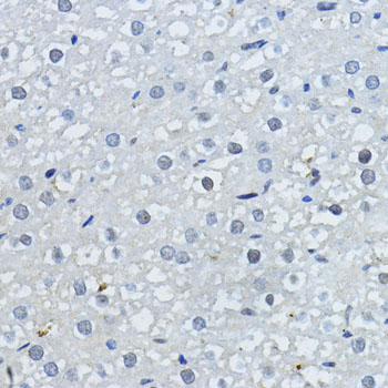 Anti-p27 Kip 1 Rabbit pAb