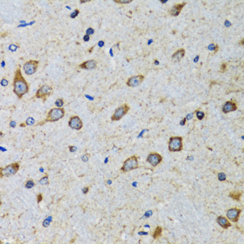 Anti-CDK1 Rabbit pAb