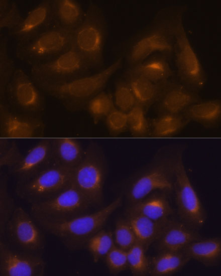 Anti-Caspase 9 Rabbit pAb
