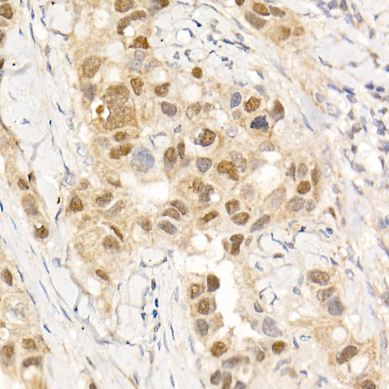 Anti-ABL1 Rabbit pAb