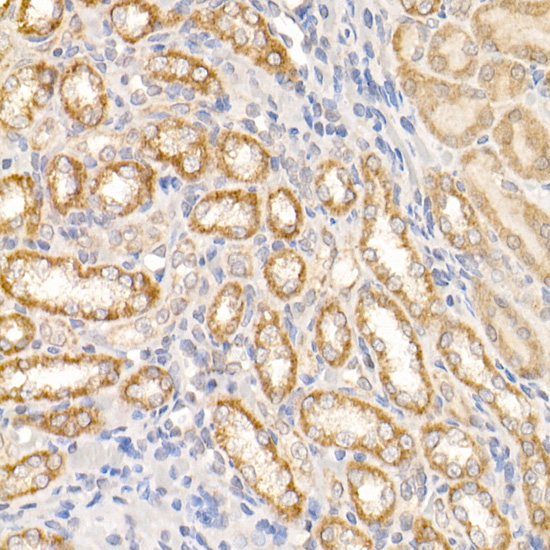 Anti-ABL1 Rabbit pAb