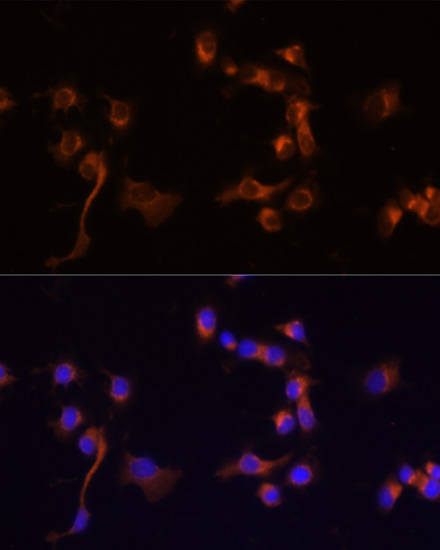 Anti-ABL1 Rabbit pAb