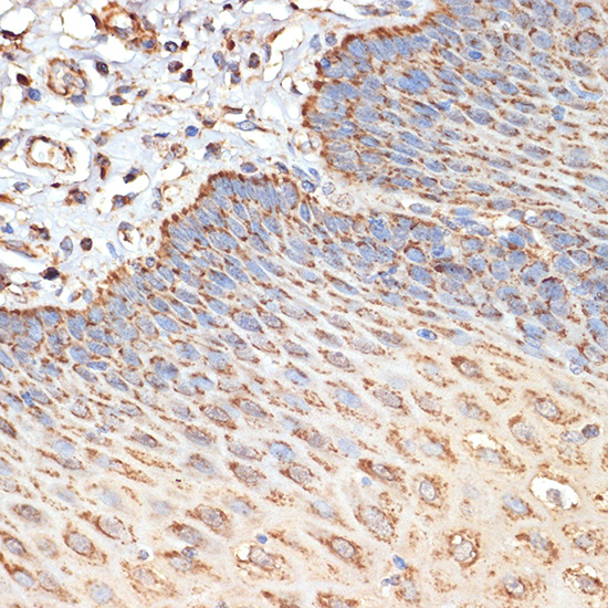 Anti-Tuberin Rabbit pAb