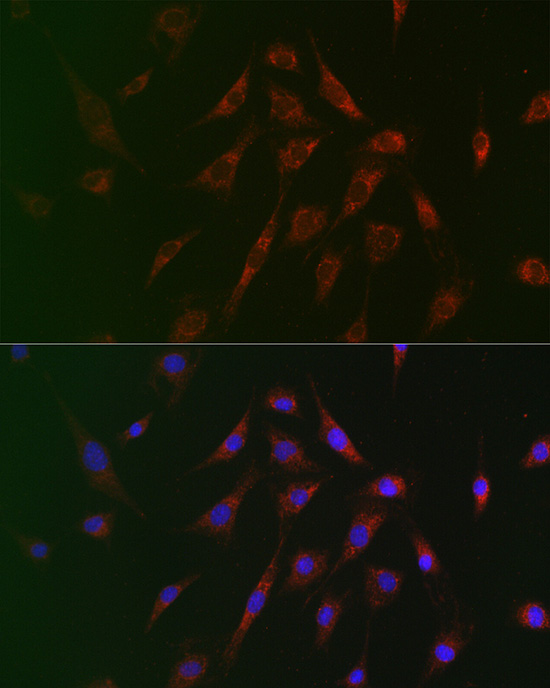 Anti-Tuberin Rabbit pAb