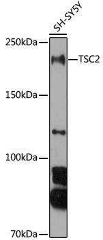 Anti-Tuberin Rabbit pAb