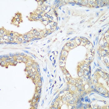 Anti-CBL Rabbit pAb