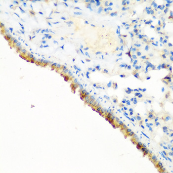 Anti-CBL Rabbit pAb