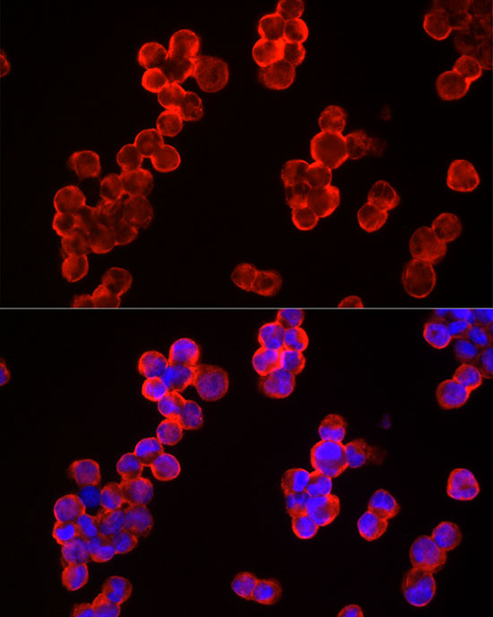 Anti-CBL Rabbit pAb