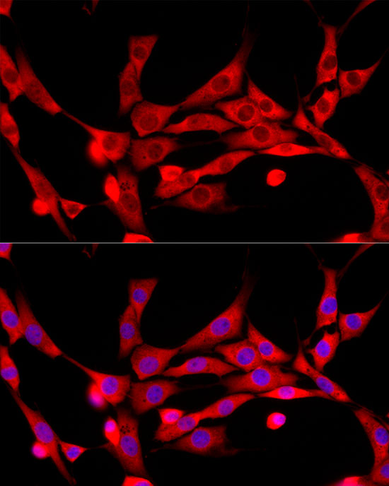Anti-CBL Rabbit pAb