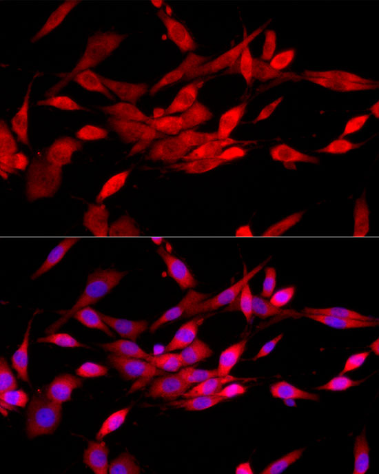 Anti-CBL Rabbit pAb