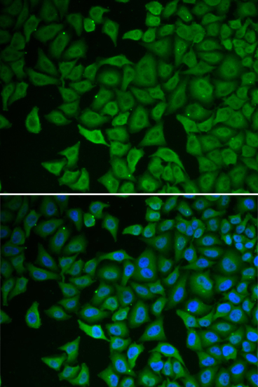 Anti-Chk2 Rabbit pAb