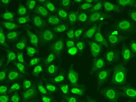 Anti-Chk2 Rabbit pAb