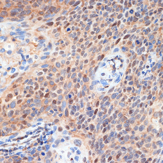 [KO Validated] Anti-CDK2 Rabbit pAb