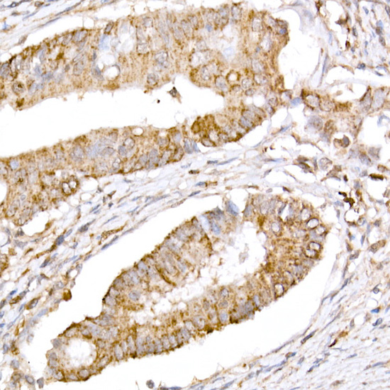Anti-ATG7 Rabbit pAb