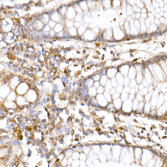 Anti-ATG7 Rabbit pAb