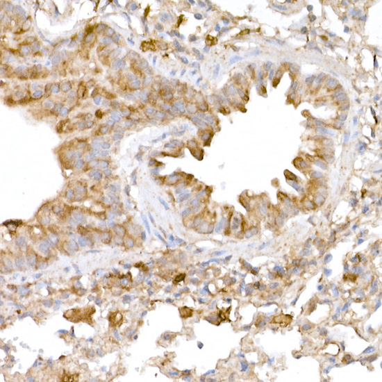 Anti-ATG7 Rabbit pAb