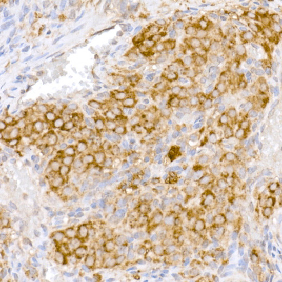 Anti-ATG7 Rabbit pAb
