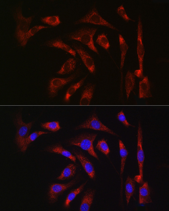 Anti-ATG7 Rabbit pAb